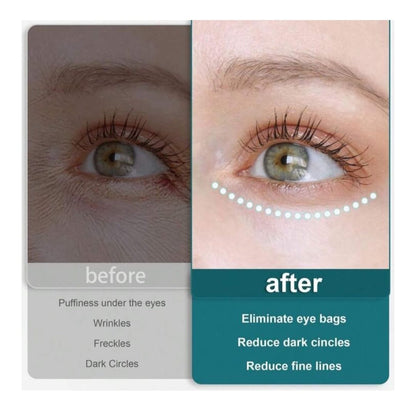 Glowvella EyeSoothe™ 3D Eye Massager